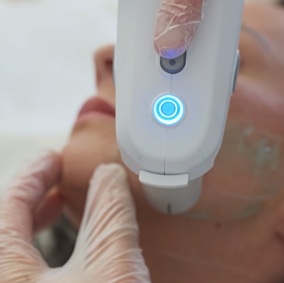 Visuel Ultherapy PRIME
