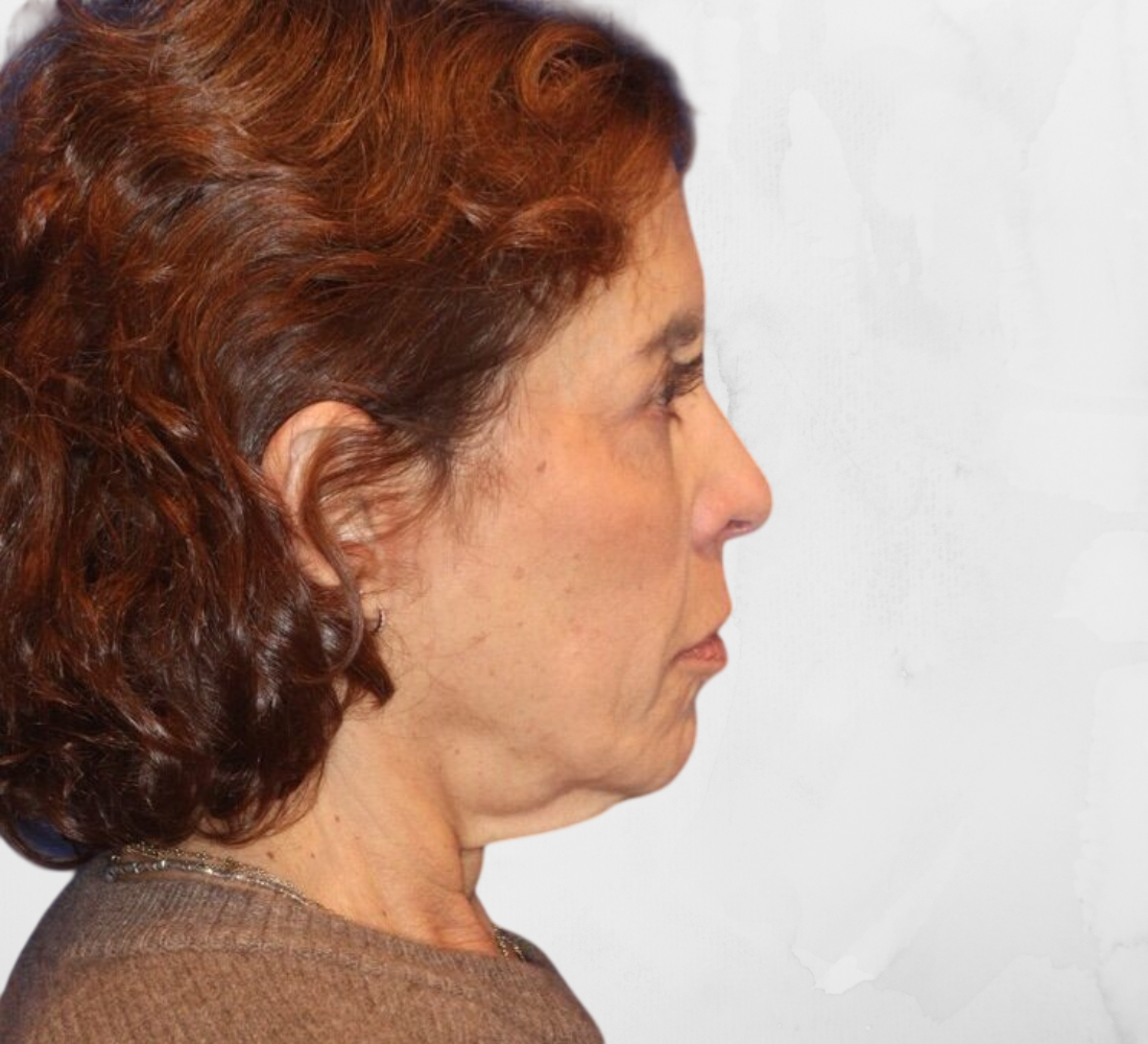 Avant traitement du profil du visage femme